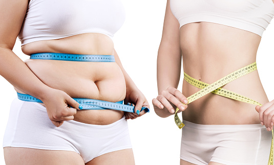 The Gender Factor in Weight Loss: Does It Matter?