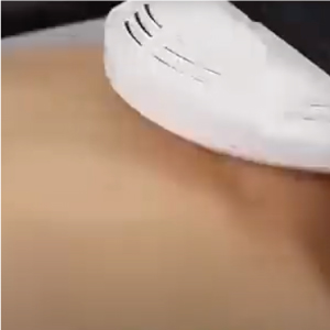 Viscera X for Abdomen