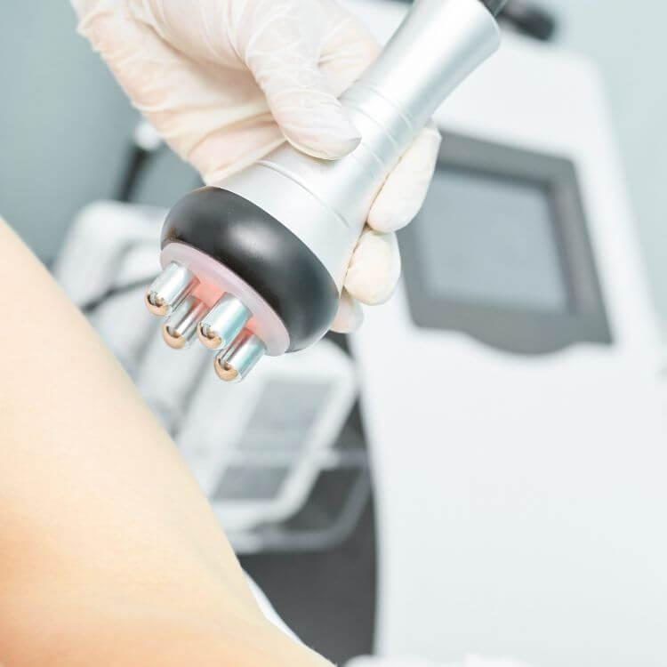 RF Slimming Treatment