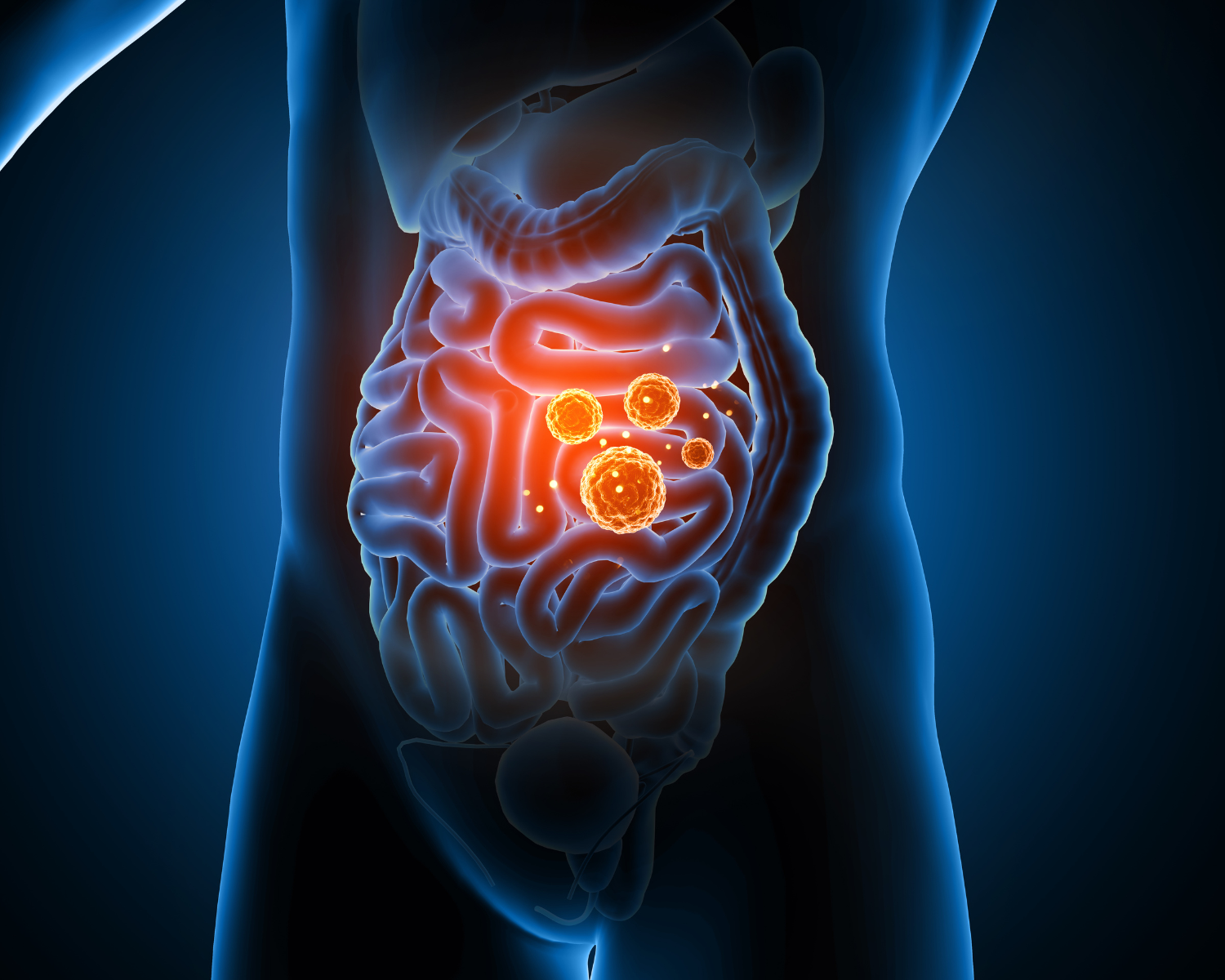 The Connection Between Your Gut and Weight