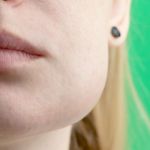 Swelling